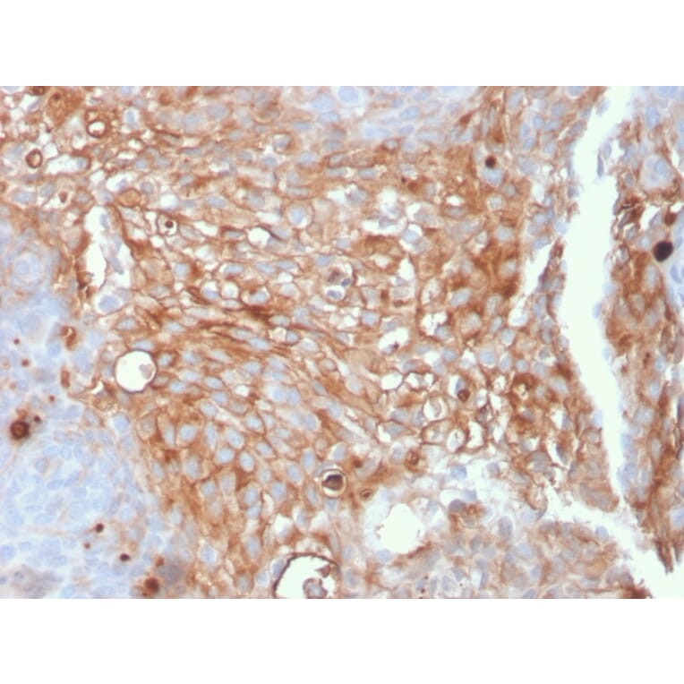 Immunohistochemistry - Anti-Uroplakin 1A Antibody [UPK1A/2925] (A248186) - Antibodies.com
