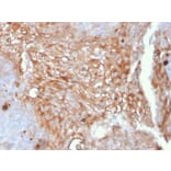 Immunohistochemistry - Anti-Uroplakin 1A Antibody [UPK1A/2925] (A248186) - Antibodies.com