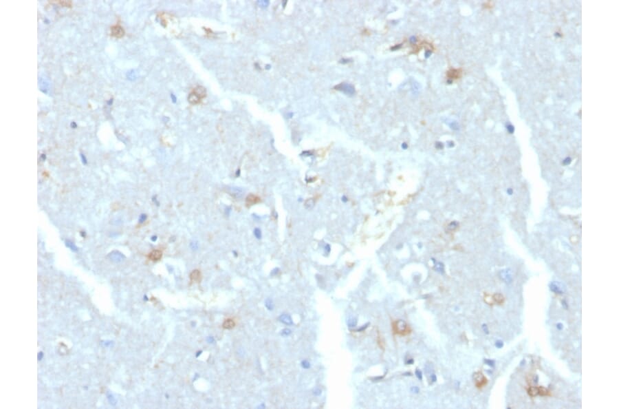 Immunohistochemistry - Anti-UBE2C Antibody [CPTC-UBE2C-1] (A248186) - Antibodies.com