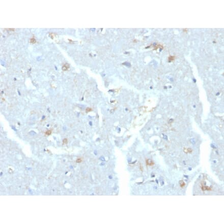 Immunohistochemistry - Anti-UBE2C Antibody [CPTC-UBE2C-1] (A248186) - Antibodies.com