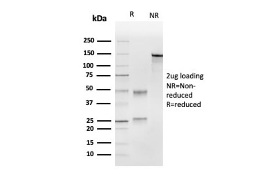 SDS-PAGE - Anti-UBE2C Antibody [CPTC-UBE2C-1] (A248187) - Antibodies.com