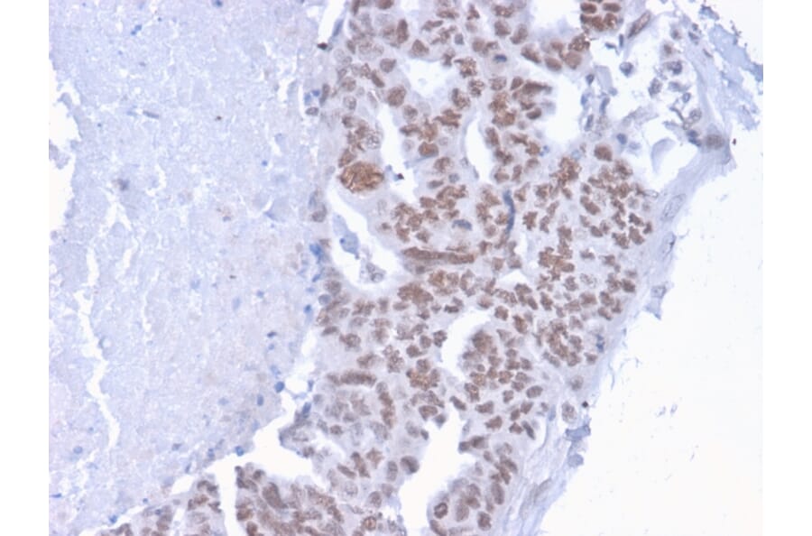 Immunohistochemistry - Anti-CHD4 Antibody [3F2/4] (A248188) - Antibodies.com