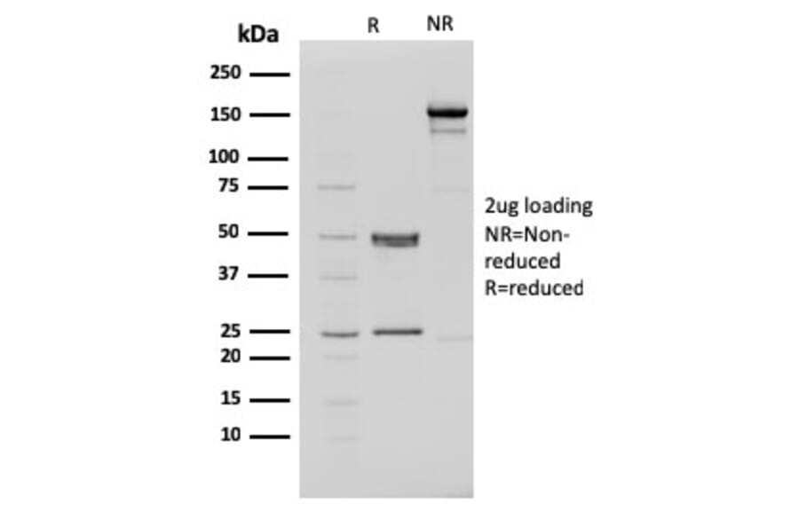 SDS-PAGE - Anti-CHD4 Antibody [3F2/4] (A248188) - Antibodies.com