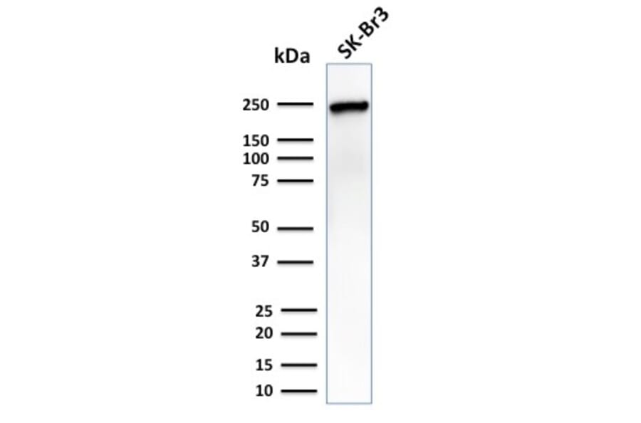 Western Blot - Anti-CHD4 Antibody [3F2/4] (A248188) - Antibodies.com