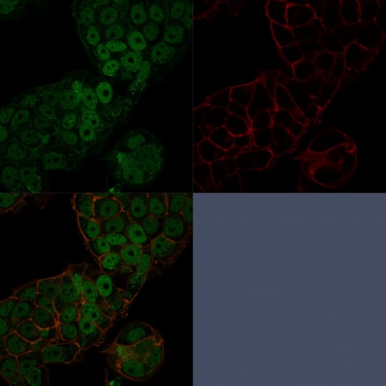 Immunofluorescence - Anti-CHD4 Antibody [3F2/4] (A248187) - Antibodies.com