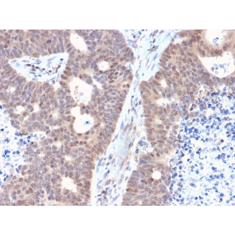 Immunohistochemistry - Anti-FAF1 Antibody [CPTC-FAF1-2] (A248189) - Antibodies.com