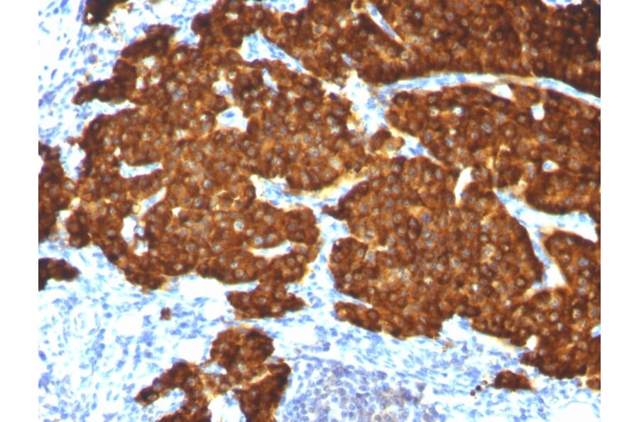Immunohistochemistry - Anti-Chromogranin A Antibody [CGA/413 + CHGA/777 + CHGA/798] (A248190) - Antibodies.com