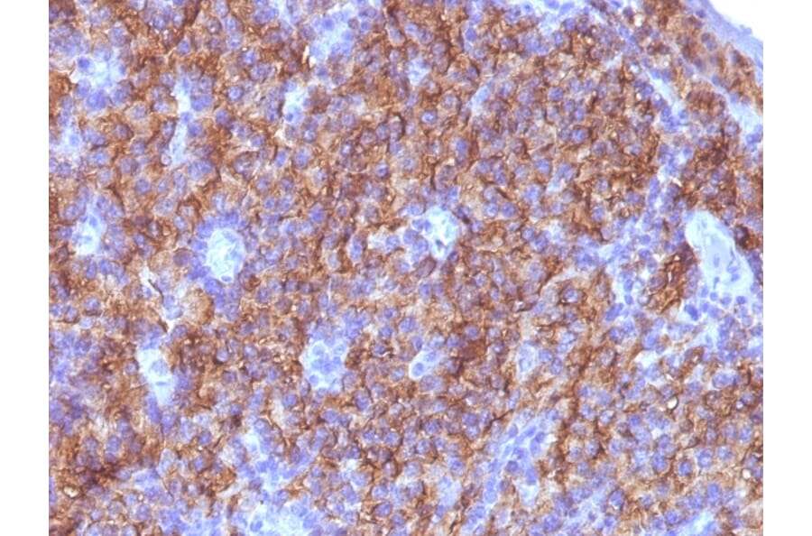 Immunohistochemistry - Anti-Chromogranin A Antibody [CGA/413 + CHGA/777 + CHGA/798] (A248190) - Antibodies.com