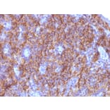Immunohistochemistry - Anti-Chromogranin A Antibody [CGA/413 + CHGA/777 + CHGA/798] (A248190) - Antibodies.com