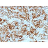Immunohistochemistry - Anti-Chromogranin A Antibody [CGA/413 + CHGA/777 + CHGA/798] (A248189) - Antibodies.com