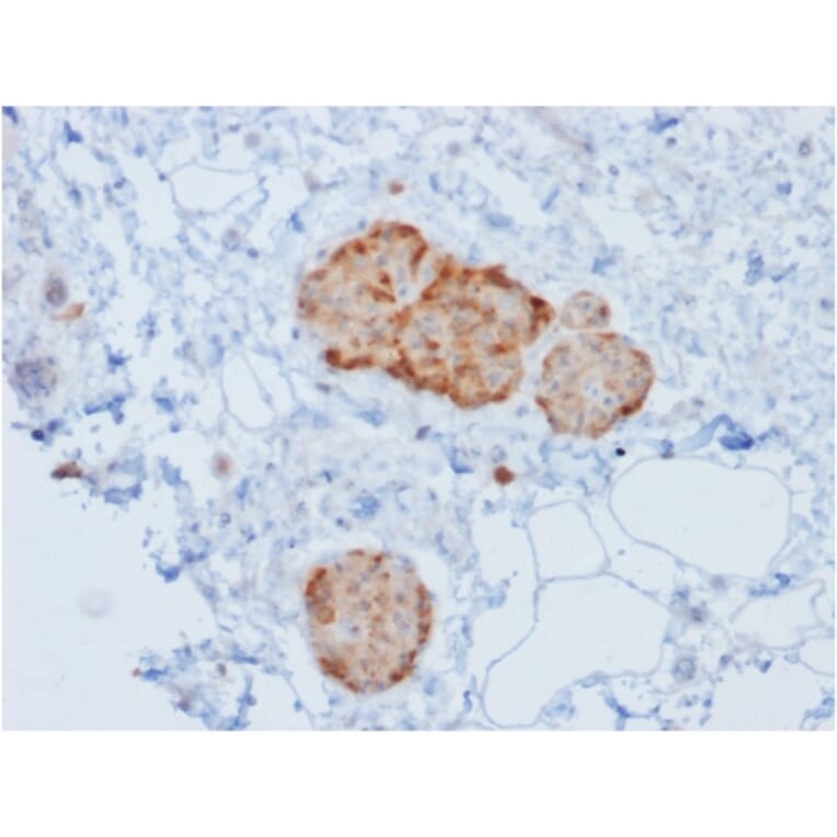 Immunohistochemistry - Anti-Chromogranin A Antibody [rCHGA/777] (A251376) - Antibodies.com