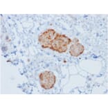 Immunohistochemistry - Anti-Chromogranin A Antibody [rCHGA/777] (A251376) - Antibodies.com