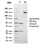 SDS-PAGE - Anti-Chromogranin A Antibody [rCHGA/798] (A248192) - Antibodies.com
