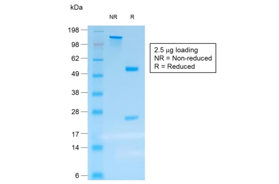 SDS-PAGE - Anti-Chromogranin A Antibody [rCHGA/413] (A248193) - Antibodies.com