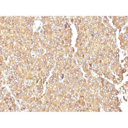 Immunohistochemistry - Anti-Chromogranin A Antibody [LK2H10] (A248195) - Antibodies.com