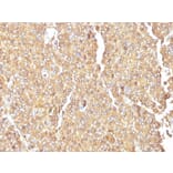 Immunohistochemistry - Anti-Chromogranin A Antibody [LK2H10] (A248195) - Antibodies.com
