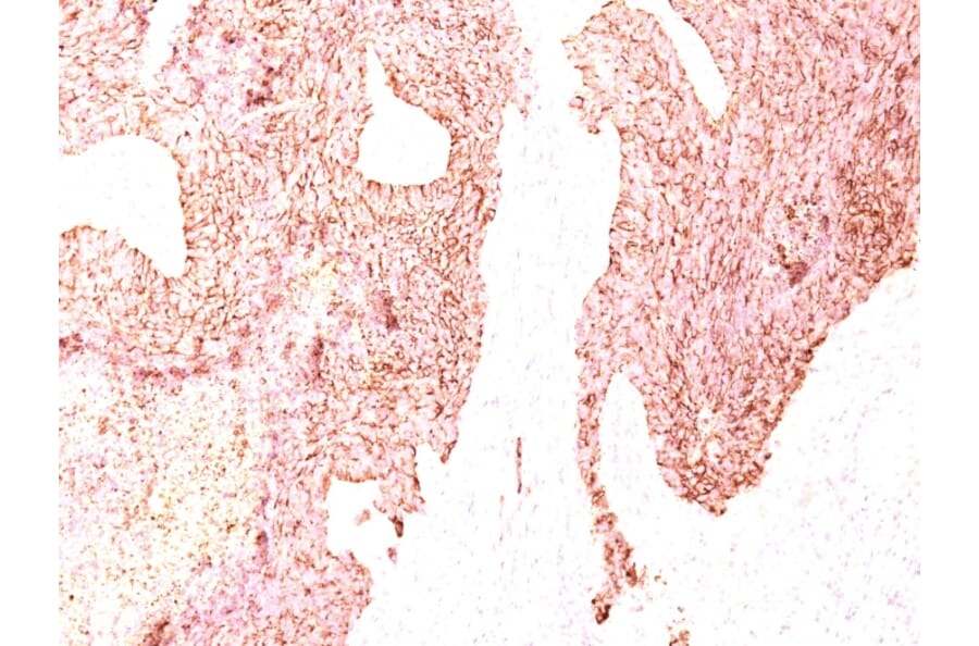 Immunohistochemistry - Anti-Chromogranin A Antibody [LK2H10] (A248196) - Antibodies.com