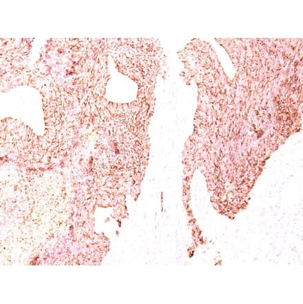 Immunohistochemistry - Anti-Chromogranin A Antibody [SPM339] (A248196) - Antibodies.com