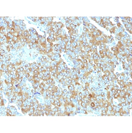 Immunohistochemistry - Anti-Chromogranin A Antibody [PHE5] (A248197) - Antibodies.com