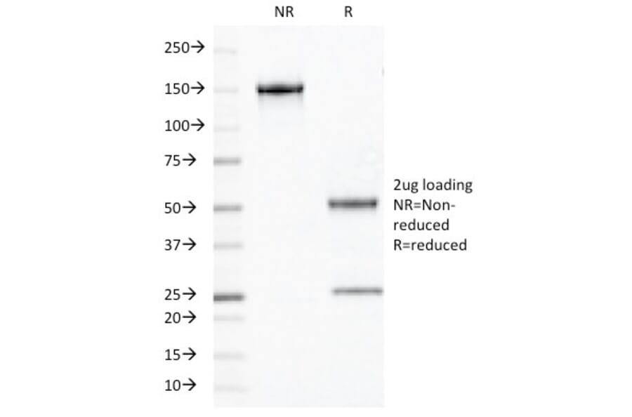 SDS-PAGE - Anti-Chromogranin A Antibody [PHE5] (A248198) - Antibodies.com