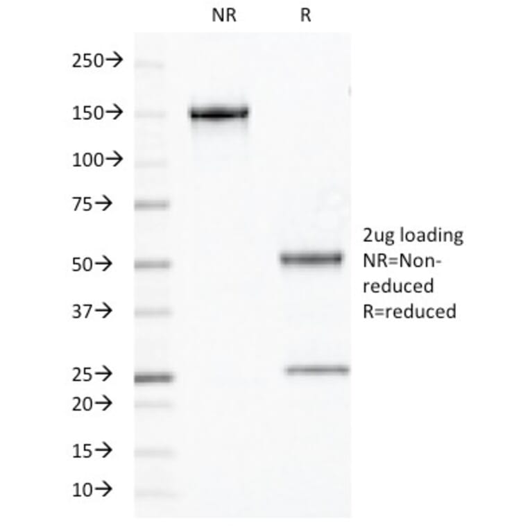 SDS-PAGE - Anti-Chromogranin A Antibody [PHE5] (A248198) - Antibodies.com