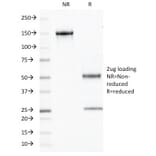 SDS-PAGE - Anti-Chromogranin A Antibody [PHE5] (A248198) - Antibodies.com