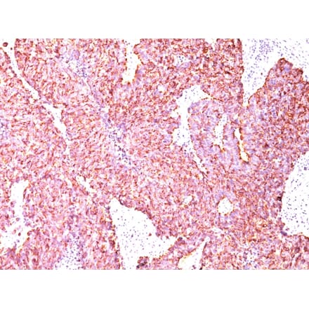 Immunohistochemistry - Anti-Chromogranin A Antibody [SPM585] (A248198) - Antibodies.com