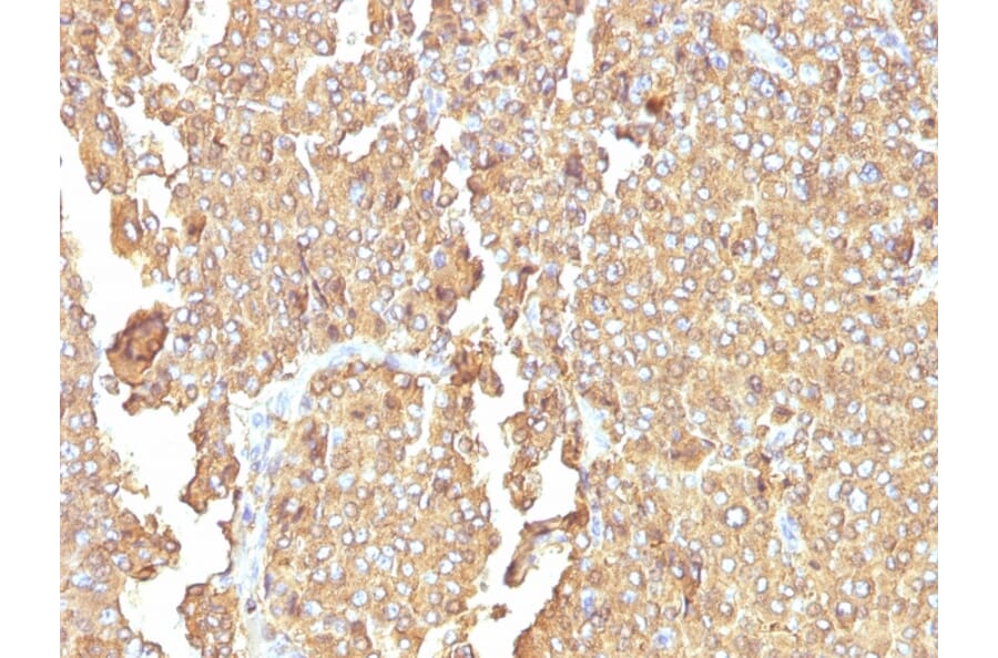 Immunohistochemistry - Anti-Chromogranin A Antibody [LK2H10 + PHE5] (A248199) - Antibodies.com