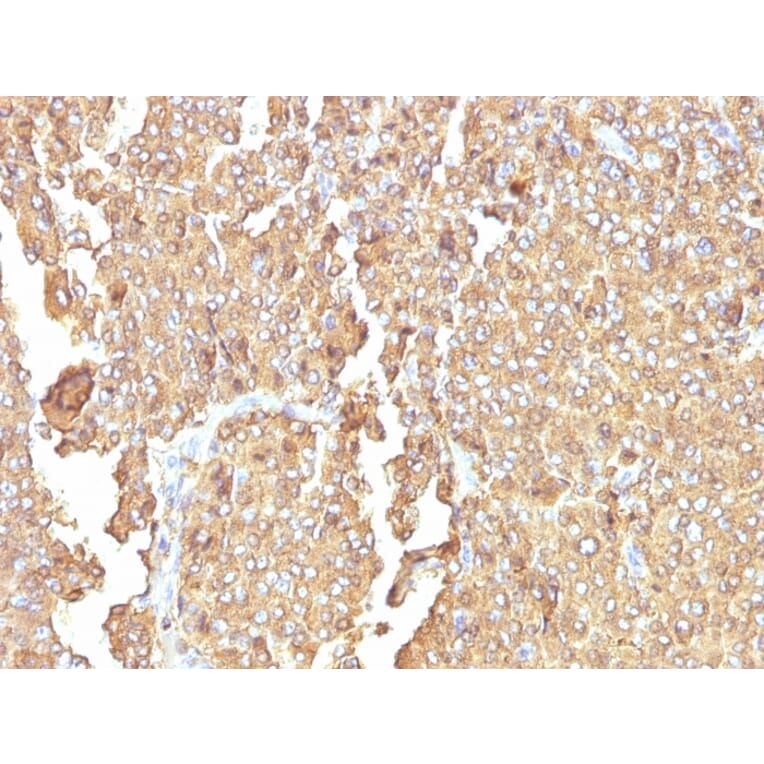 Immunohistochemistry - Anti-Chromogranin A Antibody [LK2H10 + PHE5] (A248199) - Antibodies.com
