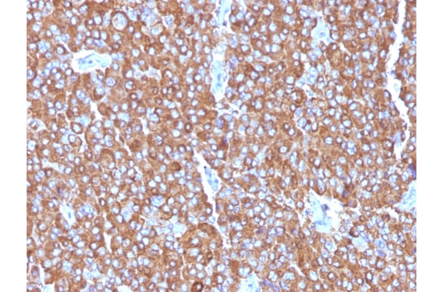 Immunohistochemistry - Anti-Chromogranin A Antibody [LK2H10 + PHE5 + CGA/414] (A248200) - Antibodies.com