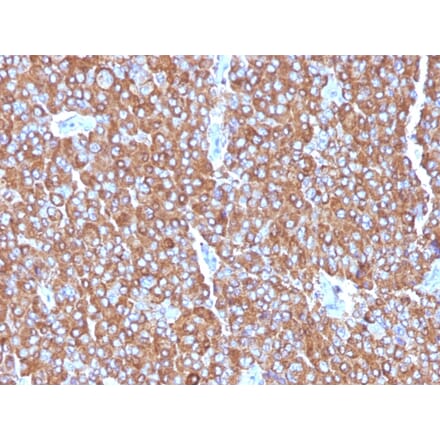 Immunohistochemistry - Anti-Chromogranin A Antibody [LK2H10 + PHE5 + CGA/414] (A248200) - Antibodies.com