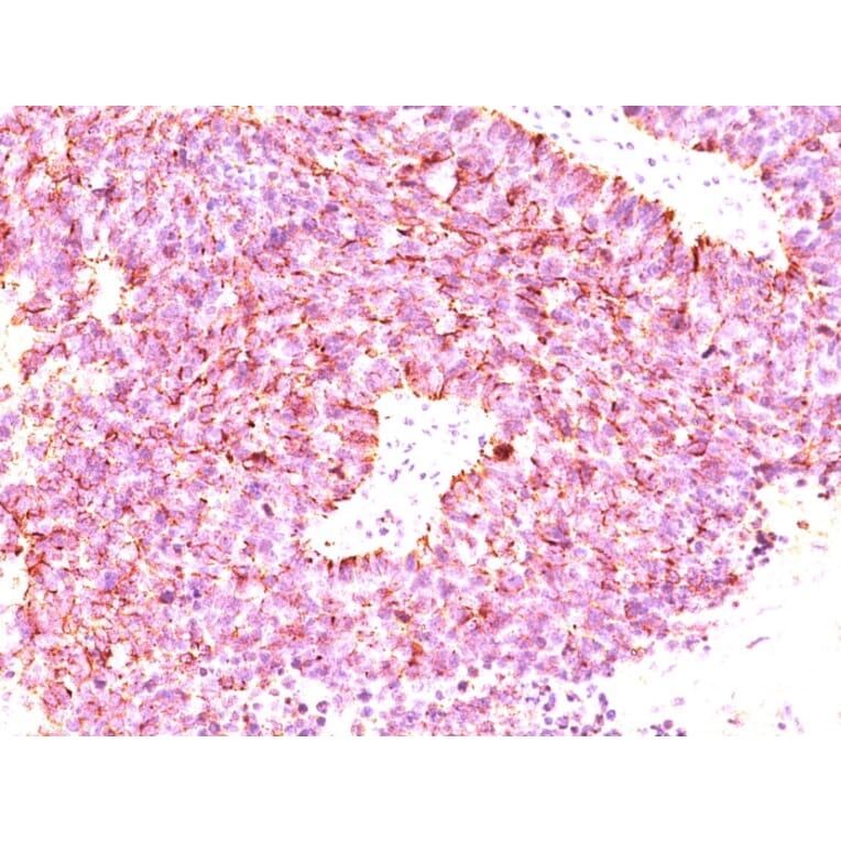 Immunohistochemistry - Anti-Chromogranin A Antibody [LK2H10 + PHE5 + CGA/414] (A248201) - Antibodies.com