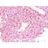 Immunohistochemistry - Anti-Chromogranin A Antibody [LK2H10 + PHE5 + CGA/414] (A248201) - Antibodies.com