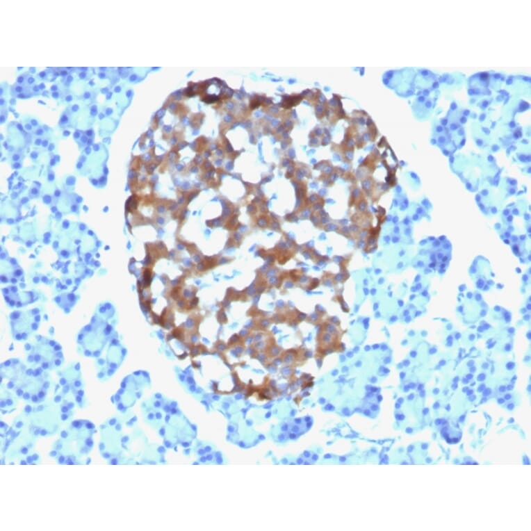 Immunohistochemistry - Anti-Chromogranin A Antibody [CHGA/765] (A248202) - Antibodies.com
