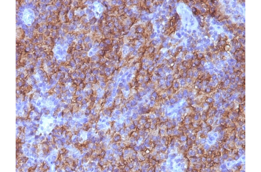 Immunohistochemistry - Anti-Chromogranin A Antibody [CHGA/765] (A248202) - Antibodies.com