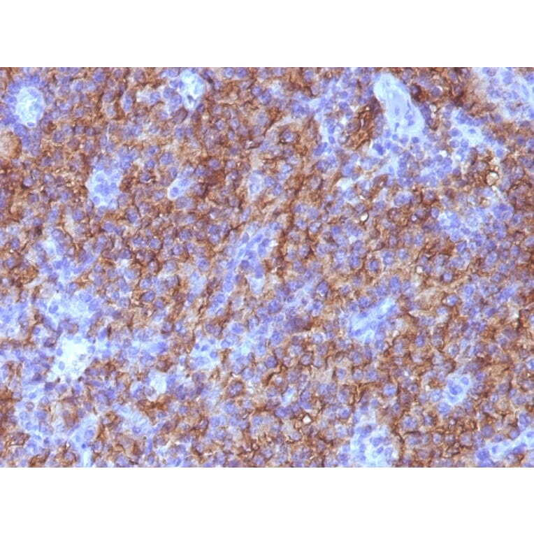 Immunohistochemistry - Anti-Chromogranin A Antibody [CHGA/765] (A248202) - Antibodies.com
