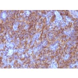 Immunohistochemistry - Anti-Chromogranin A Antibody [CHGA/765] (A248202) - Antibodies.com