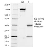 SDS-PAGE - Anti-Chromogranin A Antibody [CHGA/765] (A248202) - Antibodies.com