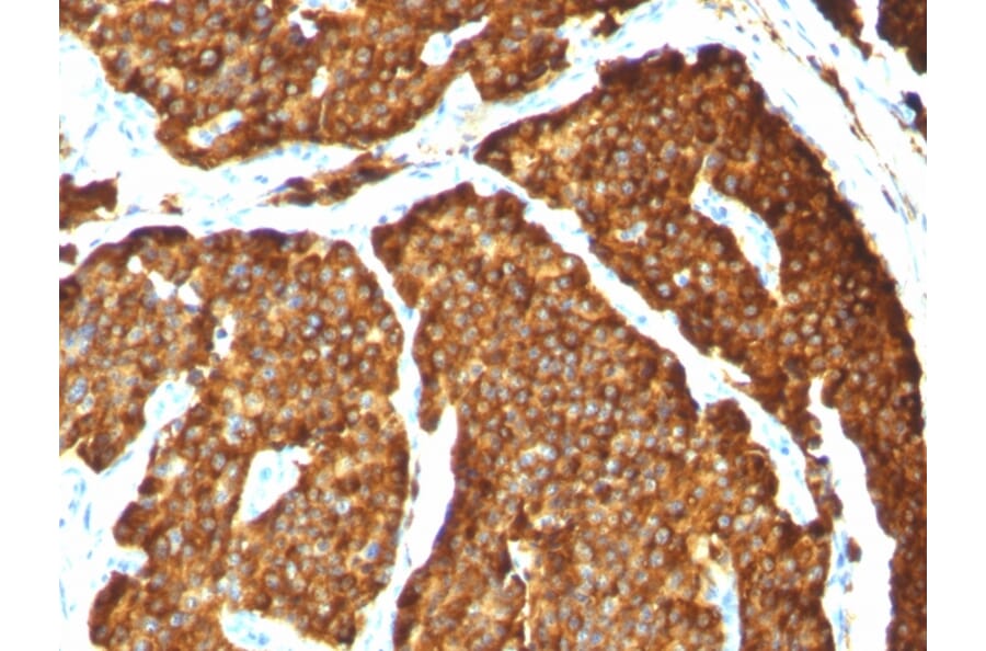 Immunohistochemistry - Anti-Chromogranin A Antibody [CHGA/777] (A248203) - Antibodies.com