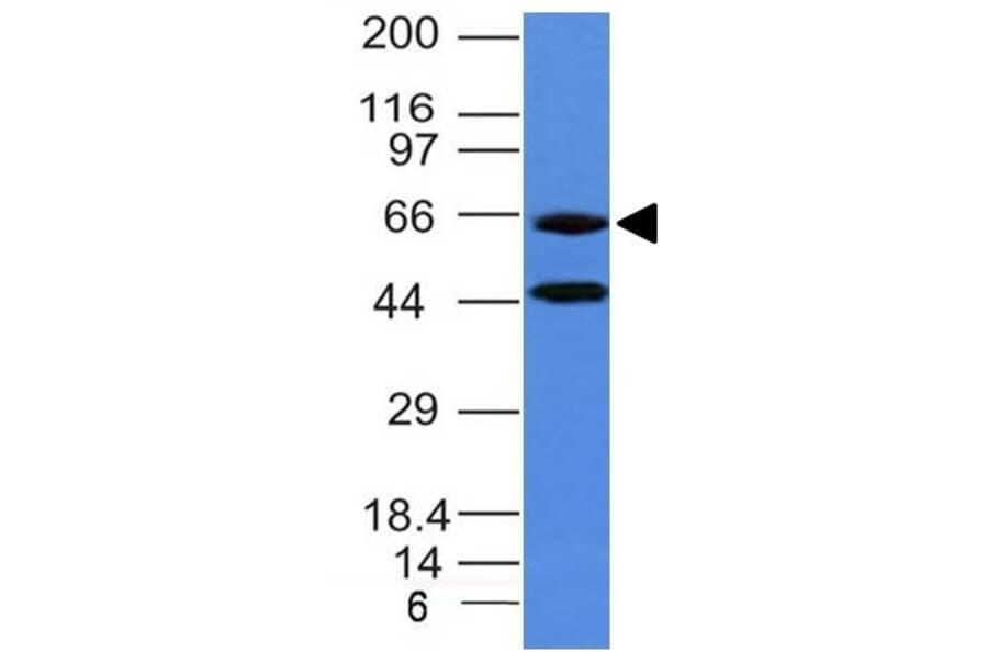 Western Blot - Anti-Chromogranin A Antibody [CHGA/777] (A248203) - Antibodies.com