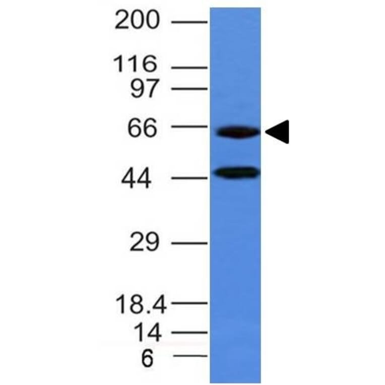 Western Blot - Anti-Chromogranin A Antibody [CHGA/777] (A248203) - Antibodies.com