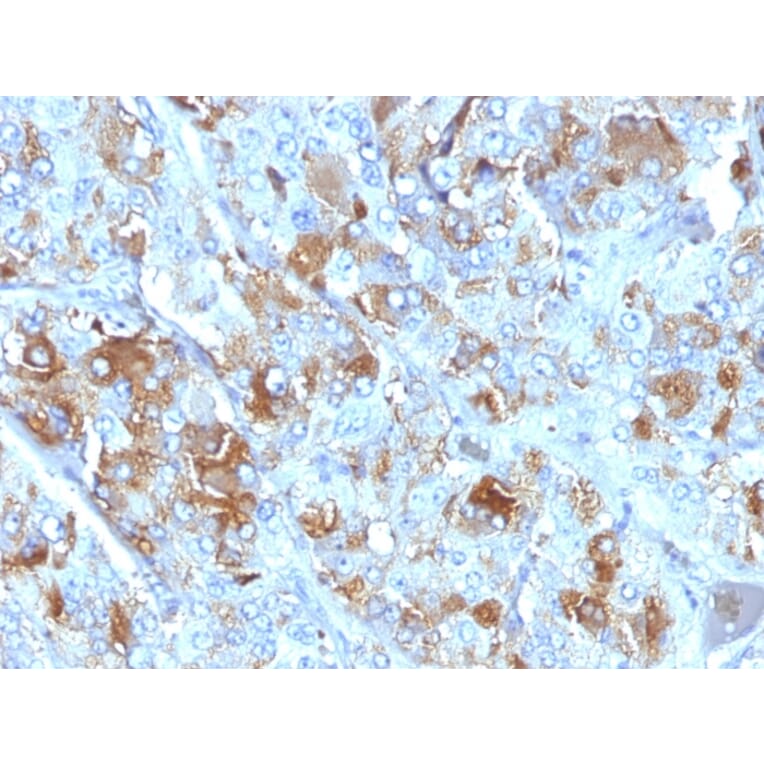 Immunohistochemistry - Anti-Chromogranin A Antibody [CHGA/777] (A248202) - Antibodies.com