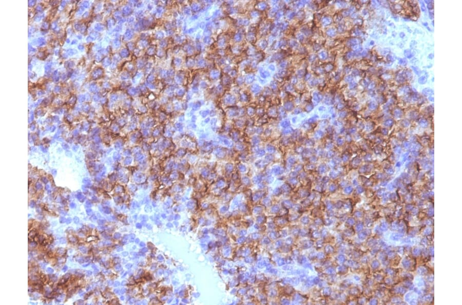 Immunohistochemistry - Anti-Chromogranin A Antibody [CHGA/798] (A248204) - Antibodies.com