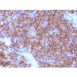 Immunohistochemistry - Anti-Chromogranin A Antibody [CHGA/798] (A248204) - Antibodies.com