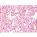 Immunohistochemistry - Anti-Chromogranin A Antibody [CHGA/798] (A248204) - Antibodies.com