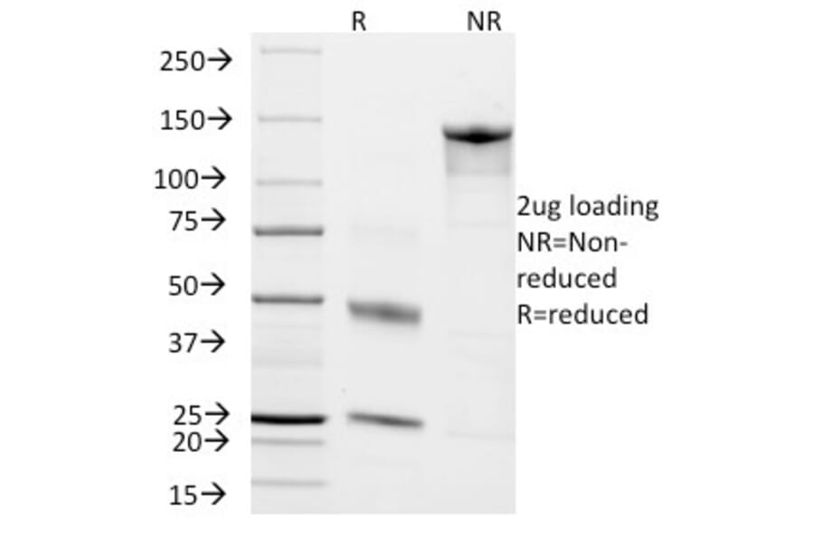 SDS-PAGE - Anti-Chromogranin A Antibody [CHGA/798] (A248204) - Antibodies.com