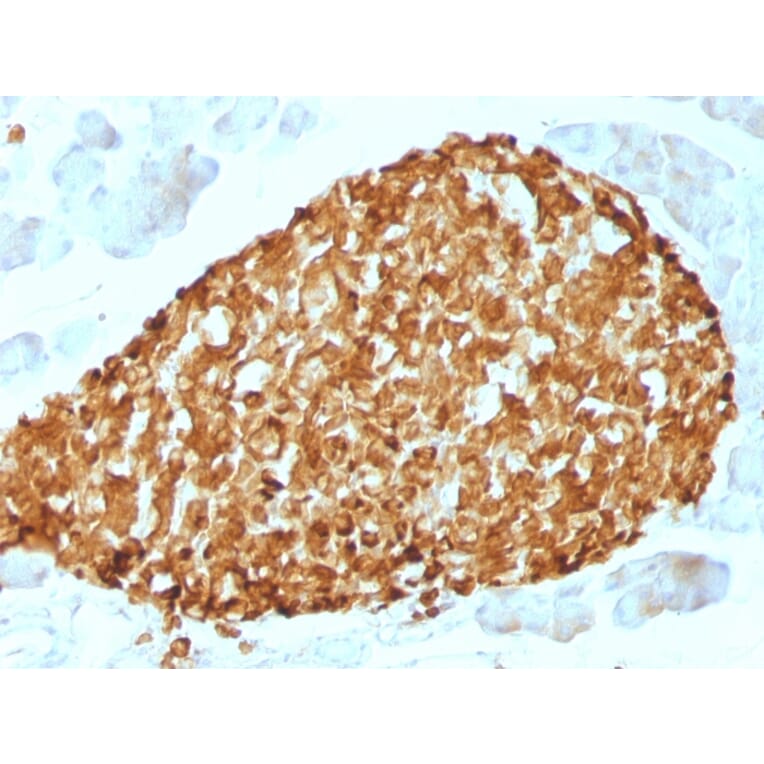 Immunohistochemistry - Anti-Chromogranin A Antibody [CHGA/798] (A248204) - Antibodies.com