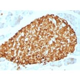 Immunohistochemistry - Anti-Chromogranin A Antibody [CHGA/798] (A248204) - Antibodies.com