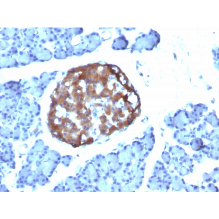 Immunohistochemistry - Anti-Chromogranin A Antibody [CHGA/798] (A248204) - Antibodies.com