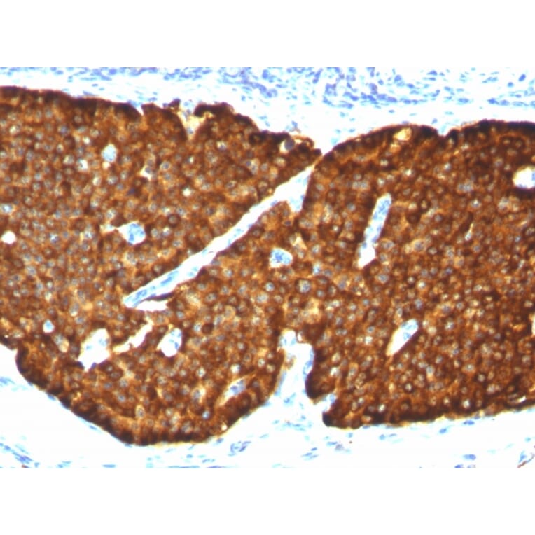 Immunohistochemistry - Anti-Chromogranin A Antibody [CGA/413] (A248205) - Antibodies.com